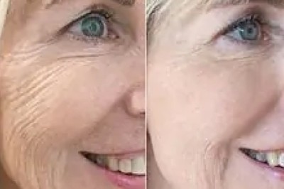 Rejuvenate Aging Skin with Skin Booster Injections in Dubai & Abu Dhabi | Glamorous Clinic in Dubai