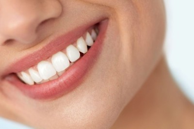 Veneers in Dubai for Chipped Teeth: Restore Your Smile