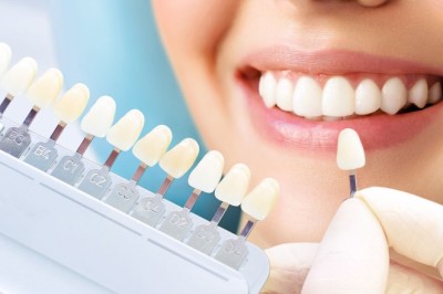 Professional Teeth Cleaning Dubai for a Bright Smile