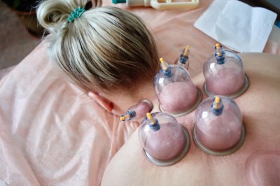 What Is Standard Hijama Treatment Cost in Dubai Range?