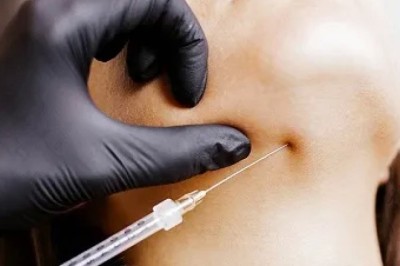 Kybella Treatments for Double Chin in Dubai | Glamorous Clinic in Dubai