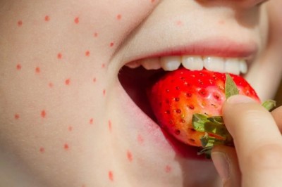 Food Intolerance Test in Dubai: Process and Benefits