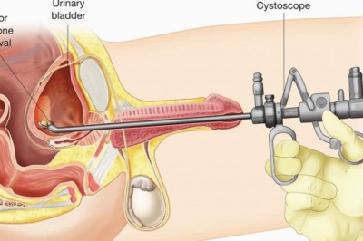 How Laparoscopic Surgery is Performed in Dubai Hospitals