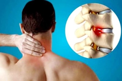Advanced Spondylosis Treatment in Faridabad | Dr. Dhruv Sharma