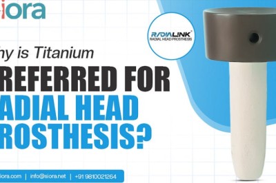 Why is Titanium Preferred for Radial Head Prosthesis?