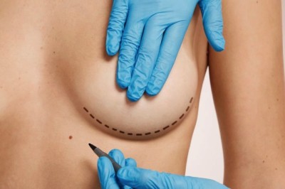 Natural-Looking Results With Breast Lift in Dubai