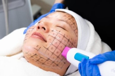 Essential Tools for High-Performance Medical and Aesthetic Solutions