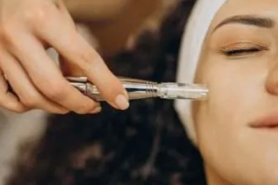 Melasma In Manchester: Modern Care for a Brighter Complexion