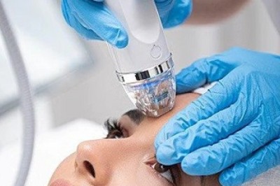 Who Benefits Long-Term from Fractional RF Microneedling?