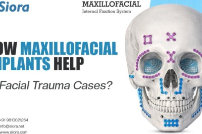 How Maxillofacial Implants Help in Facial Trauma Cases?