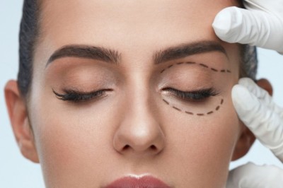 Xanthellae Removal for Smooth Eyelids in Dubai | Glamorous Clinic in Dubai